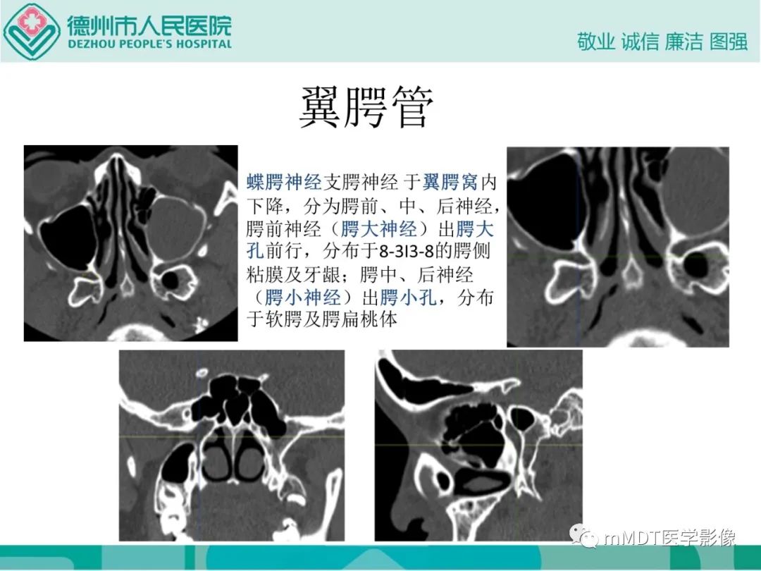 影像PPT - 【PPT】绕出崎岖孔孔道—三叉神经的颅底走形-90