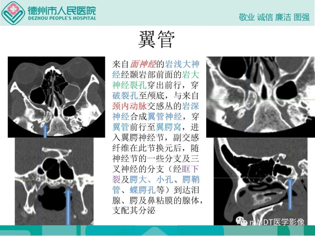 影像PPT - 【PPT】绕出崎岖孔孔道—三叉神经的颅底走形-119
