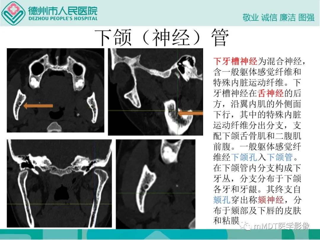 影像PPT - 【PPT】绕出崎岖孔孔道—三叉神经的颅底走形-133