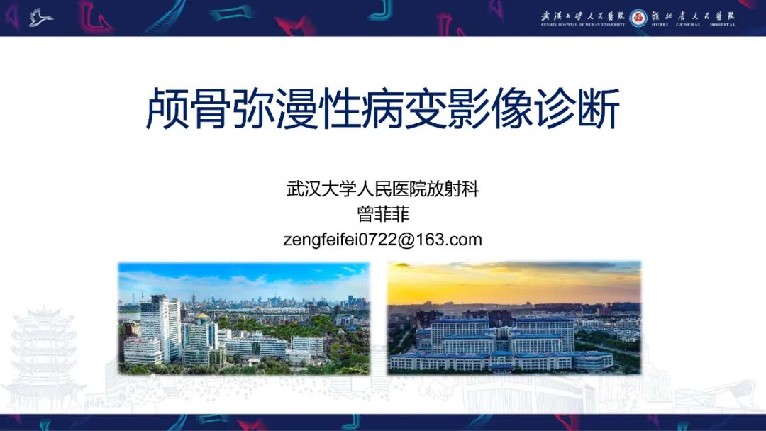 影像PPT - 【PPT】颅骨弥漫性病变影像诊断-1