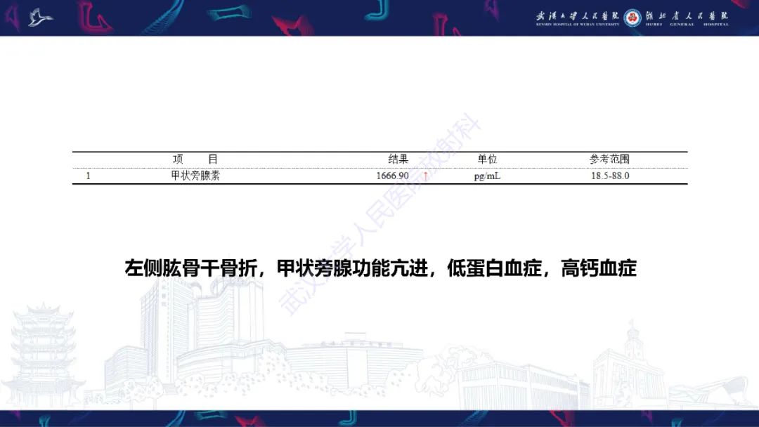 影像PPT - 【PPT】颅骨弥漫性病变影像诊断-10