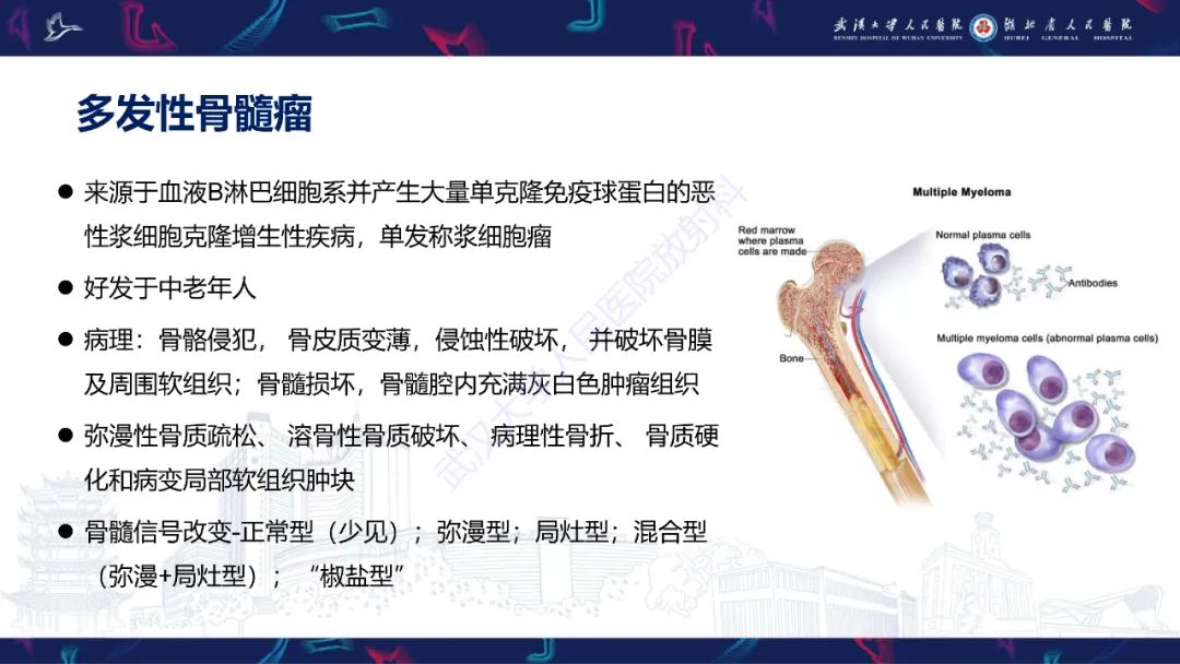 影像PPT - 【PPT】颅骨弥漫性病变影像诊断-42