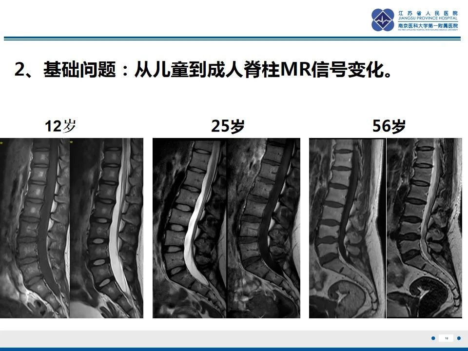 影像PPT - 【PPT】戈谢病-11
