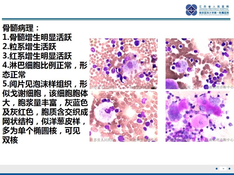 影像PPT - 【PPT】戈谢病-16