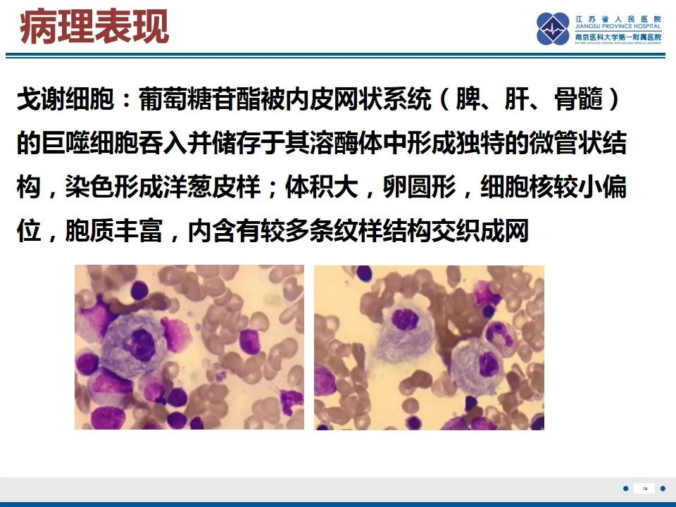 影像PPT - 【PPT】戈谢病-19