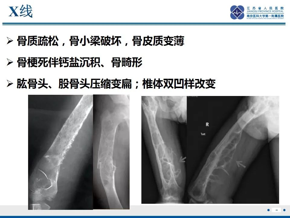 影像PPT - 【PPT】戈谢病-24