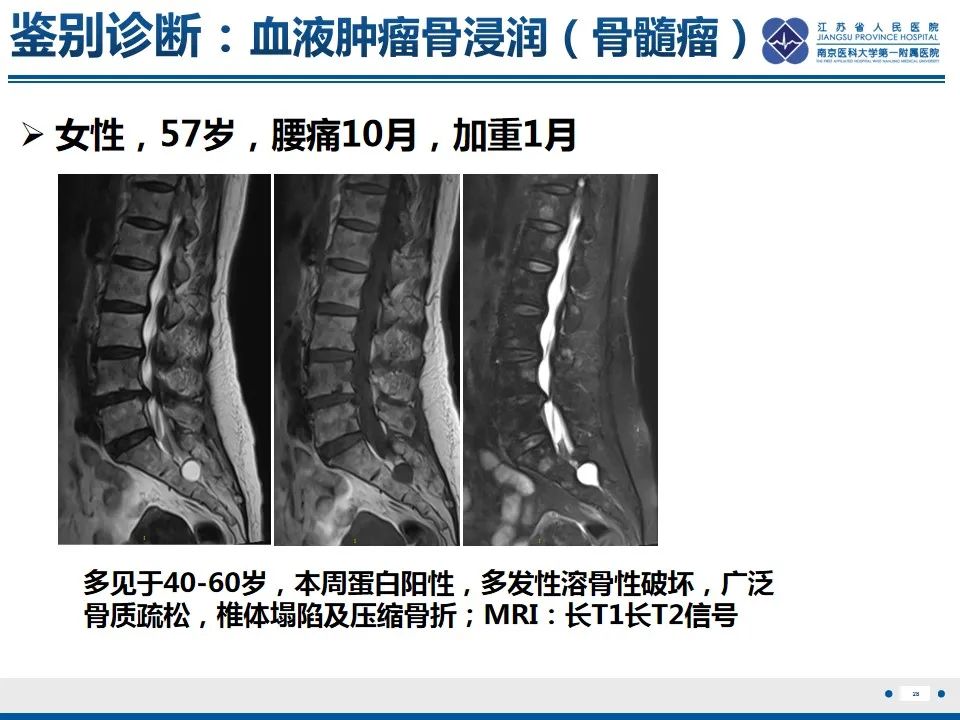 影像PPT - 【PPT】戈谢病-29