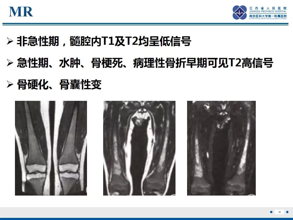 影像PPT - 【PPT】戈谢病-26