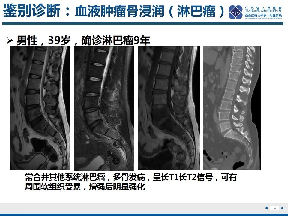 影像PPT - 【PPT】戈谢病-30