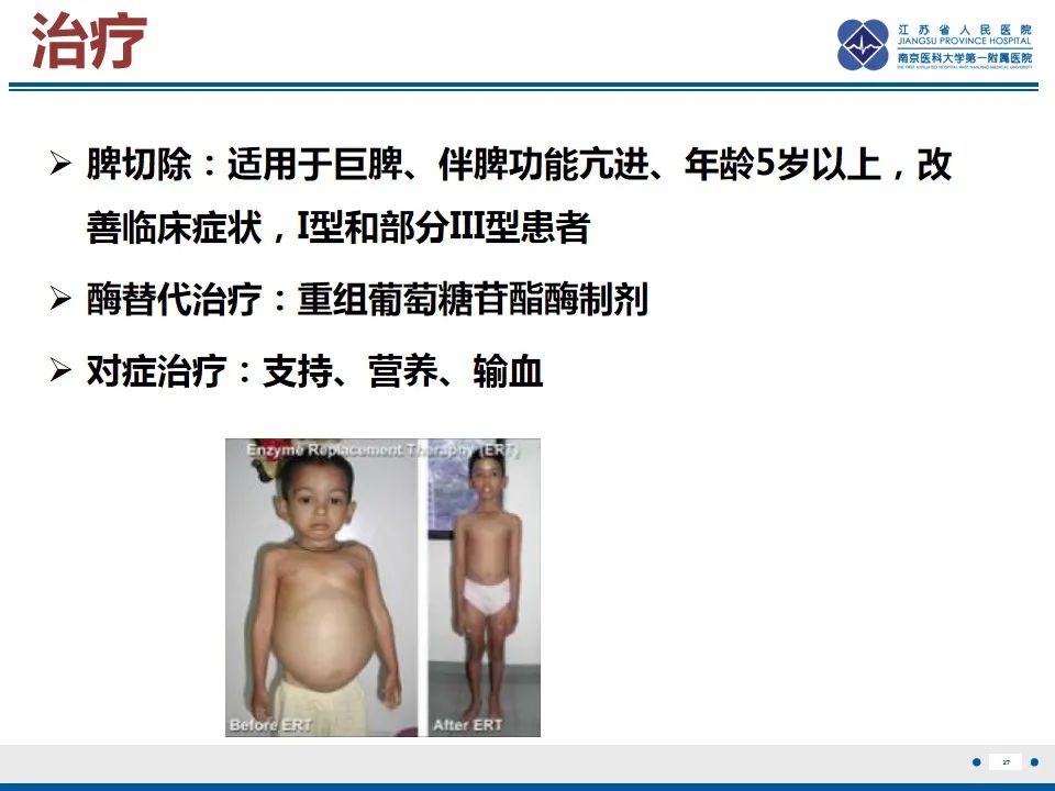 影像PPT - 【PPT】戈谢病-28