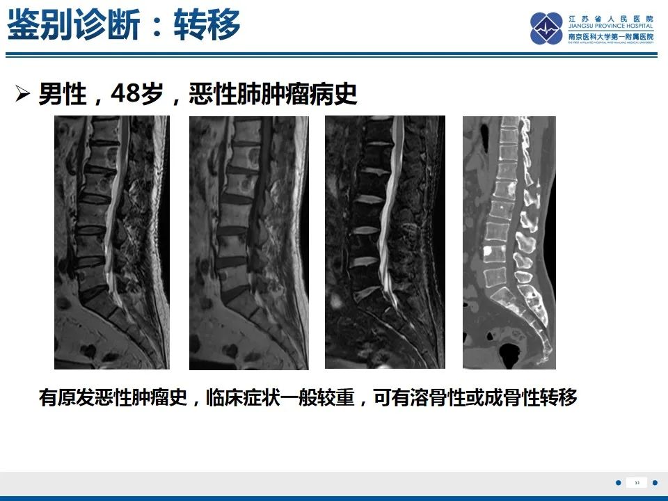 影像PPT - 【PPT】戈谢病-32