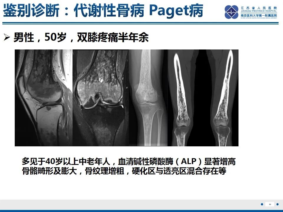 影像PPT - 【PPT】戈谢病-31