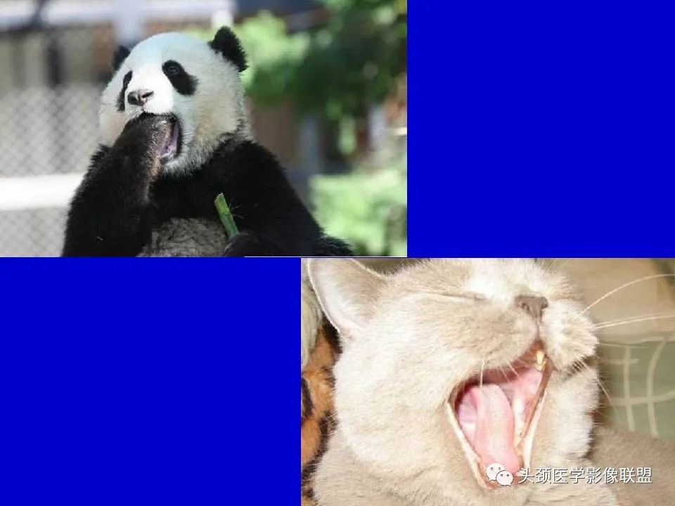 影像PPT - 【PPT】血管周围间隙的MR诊断及鉴别诊断-19