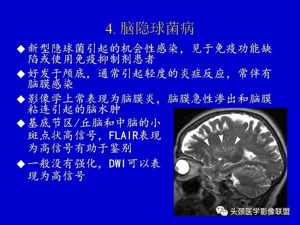 影像PPT - 【PPT】血管周围间隙的MR诊断及鉴别诊断-28