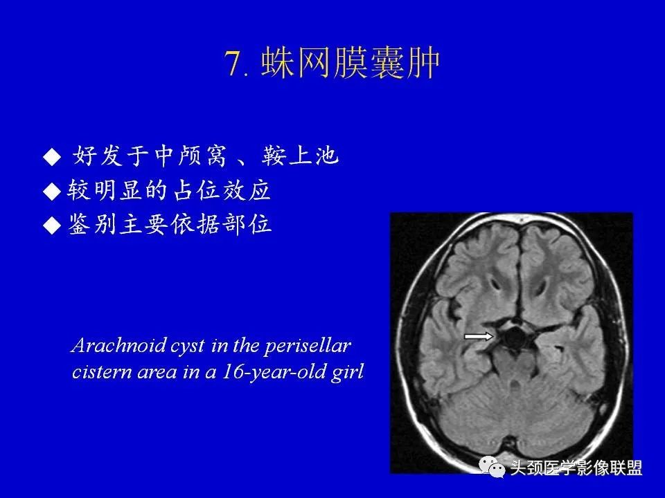 影像PPT - 【PPT】血管周围间隙的MR诊断及鉴别诊断-34