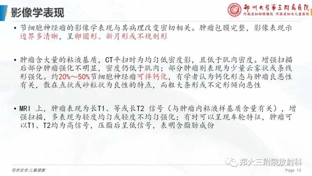 影像PPT - 【病例】腹膜后节细胞神经瘤1例影像分析-13