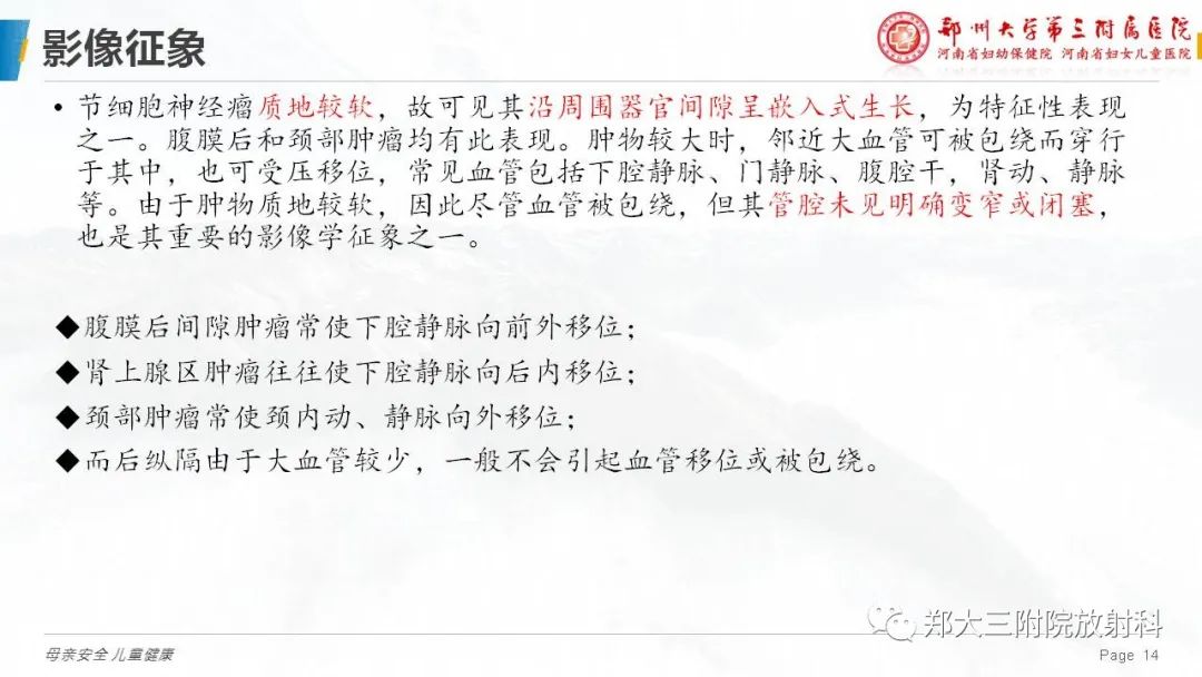 影像PPT - 【病例】腹膜后节细胞神经瘤1例影像分析-14