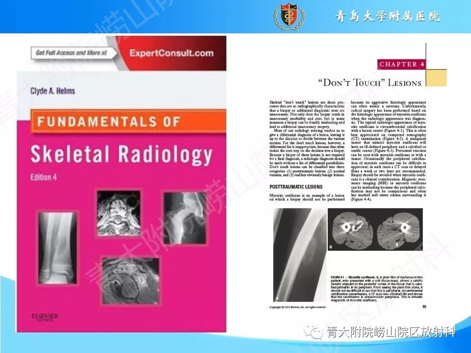 影像PPT - 【PPT】“不要碰”的骨关节病变-2