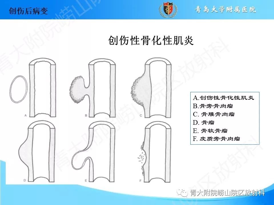 影像PPT - 【PPT】“不要碰”的骨关节病变-7