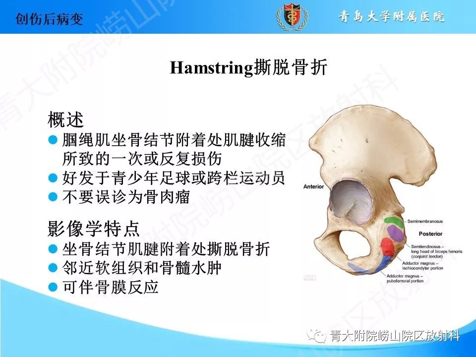 影像PPT - 【PPT】“不要碰”的骨关节病变-10