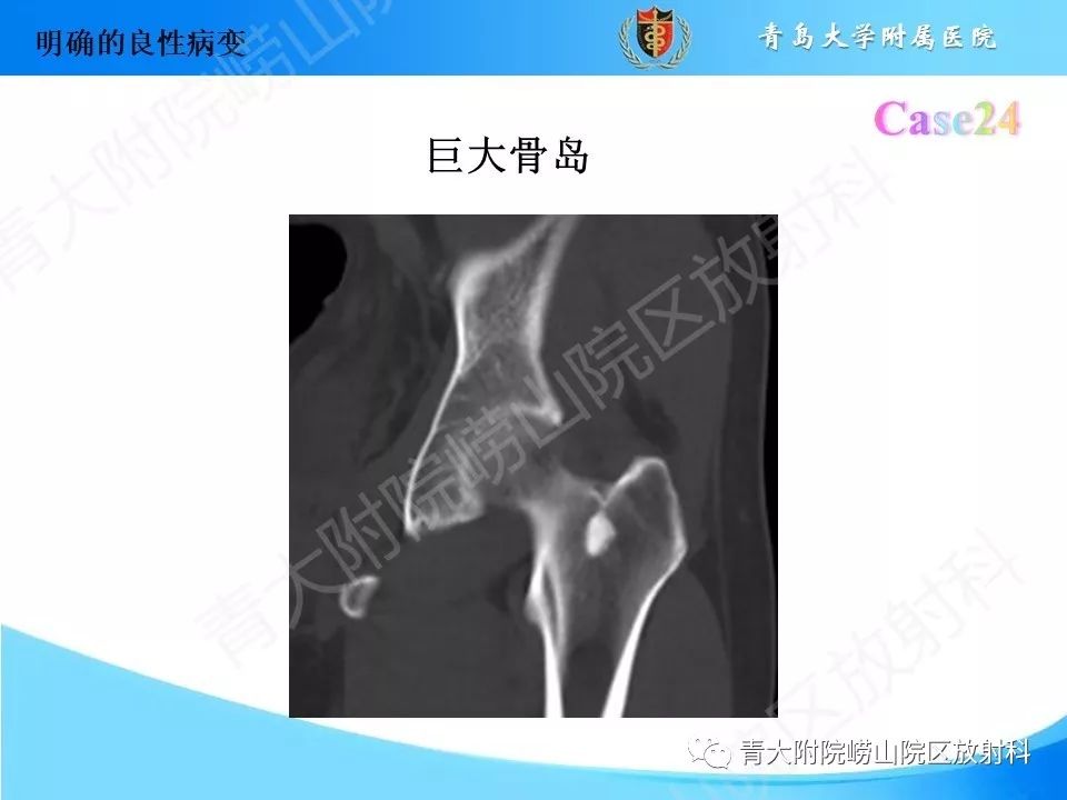 影像PPT - 【PPT】“不要碰”的骨关节病变-49
