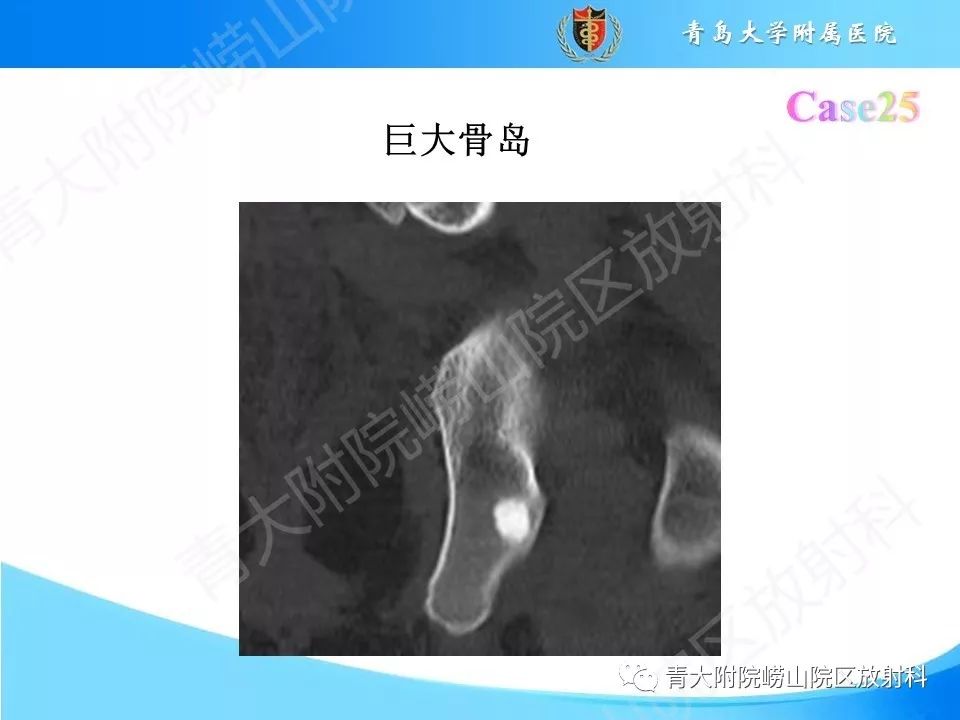 影像PPT - 【PPT】“不要碰”的骨关节病变-50