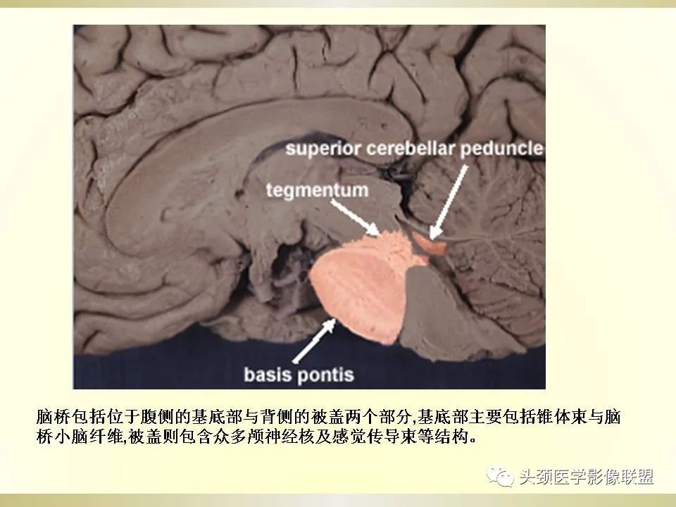 影像PPT - 【PPT】脑桥病变的定性诊断与影像学特点-2