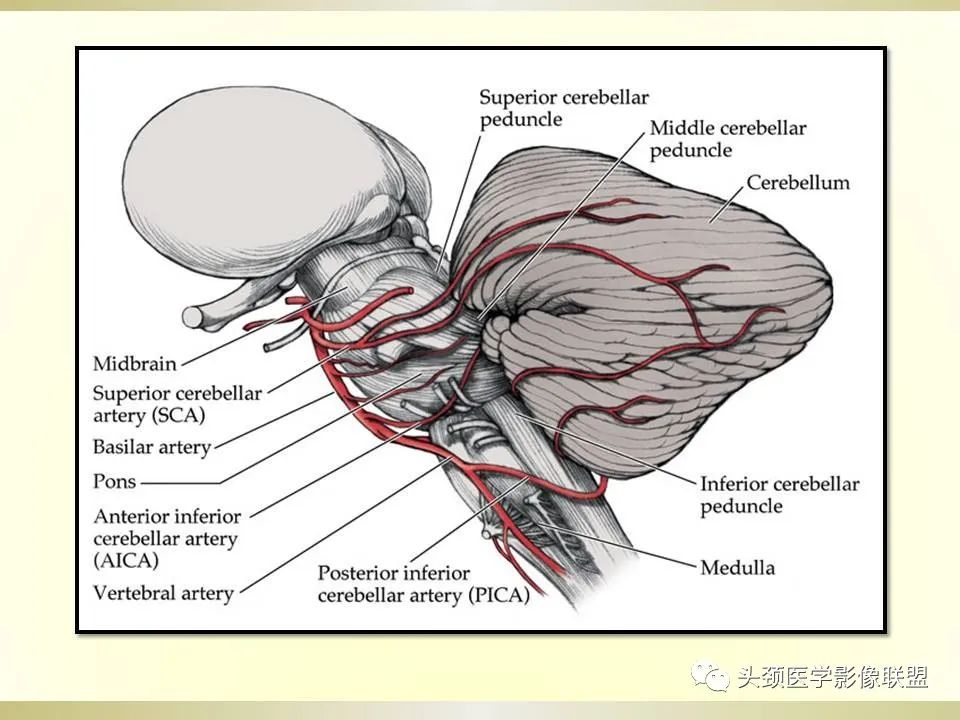 影像PPT - 【PPT】脑桥病变的定性诊断与影像学特点-5