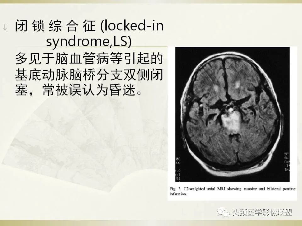 影像PPT - 【PPT】脑桥病变的定性诊断与影像学特点-13