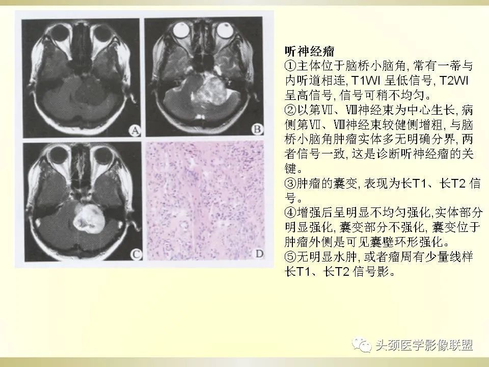 影像PPT - 【PPT】脑桥病变的定性诊断与影像学特点-58