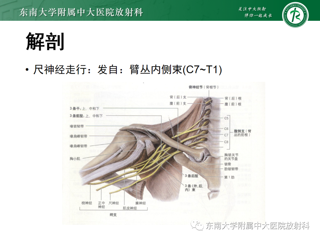 影像PPT - 【PPT】肘管综合征-7