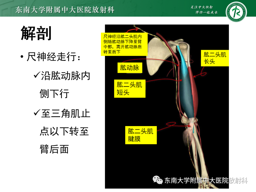 影像PPT - 【PPT】肘管综合征-8