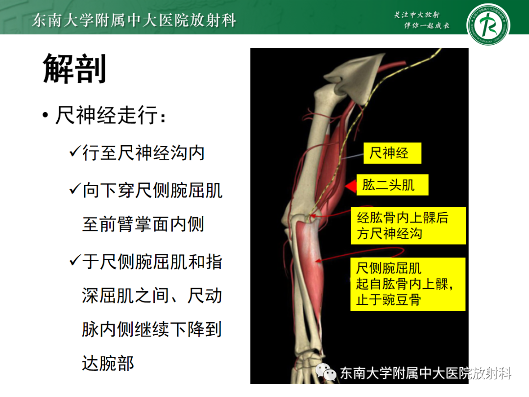 影像PPT - 【PPT】肘管综合征-9