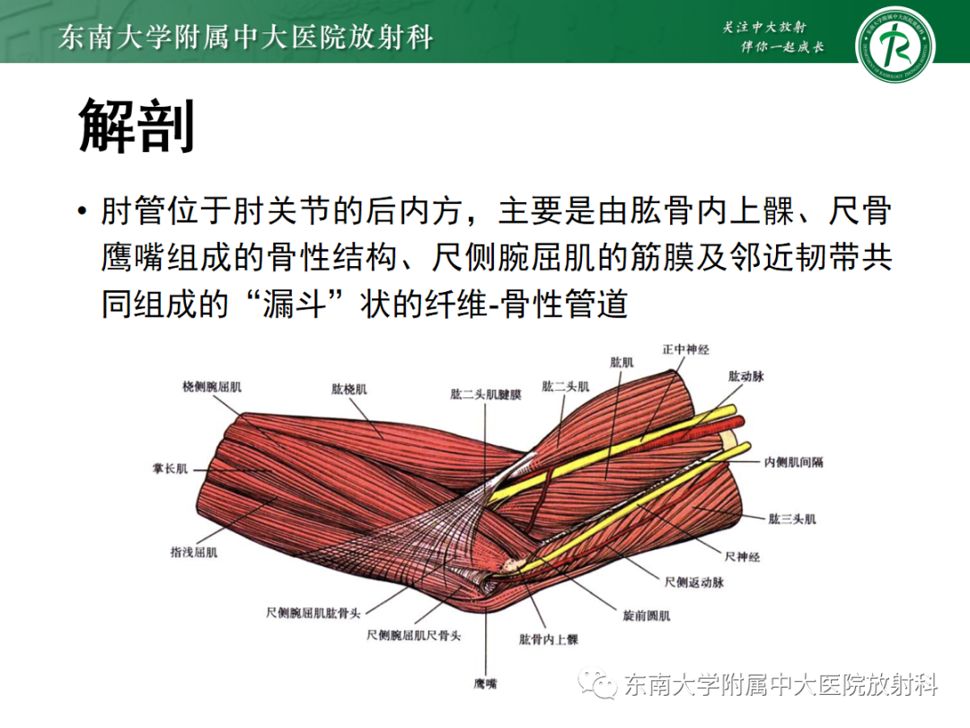 影像PPT - 【PPT】肘管综合征-10