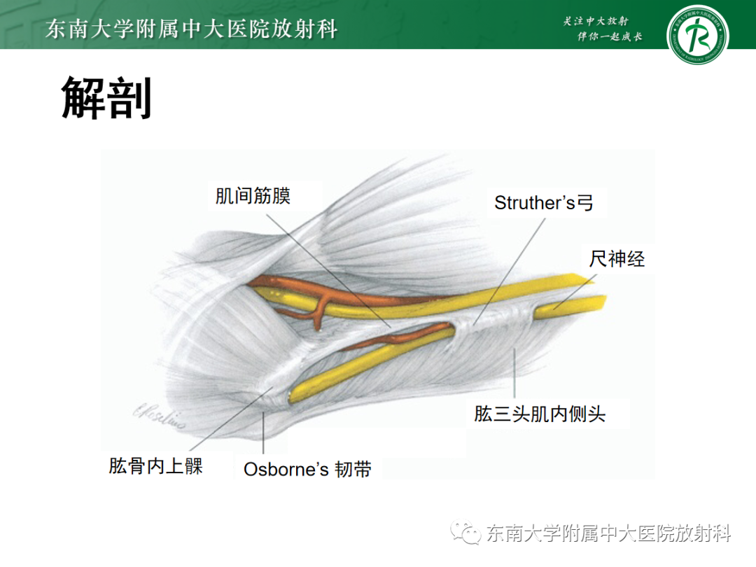 影像PPT - 【PPT】肘管综合征-11