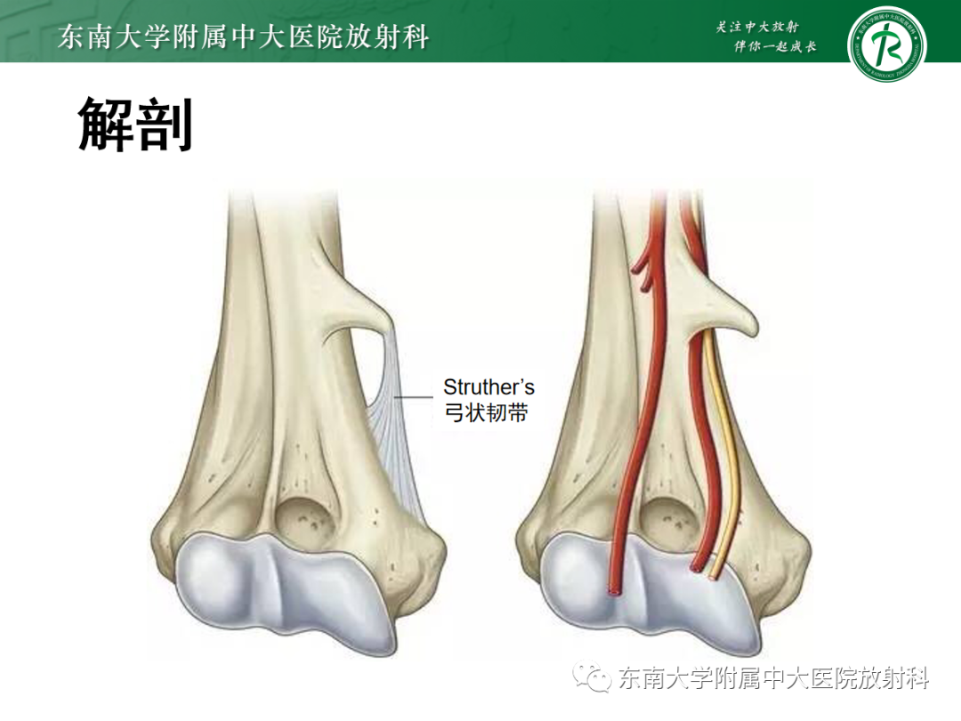 影像PPT - 【PPT】肘管综合征-12