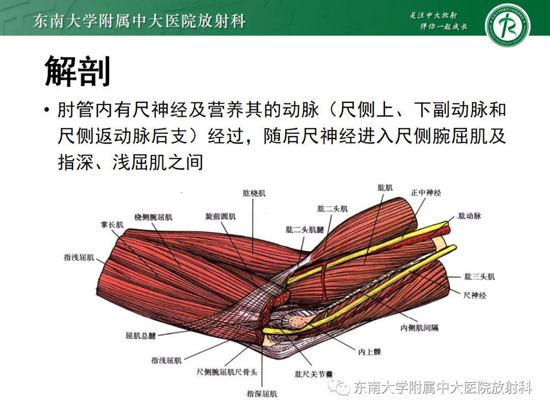 影像PPT - 【PPT】肘管综合征-13