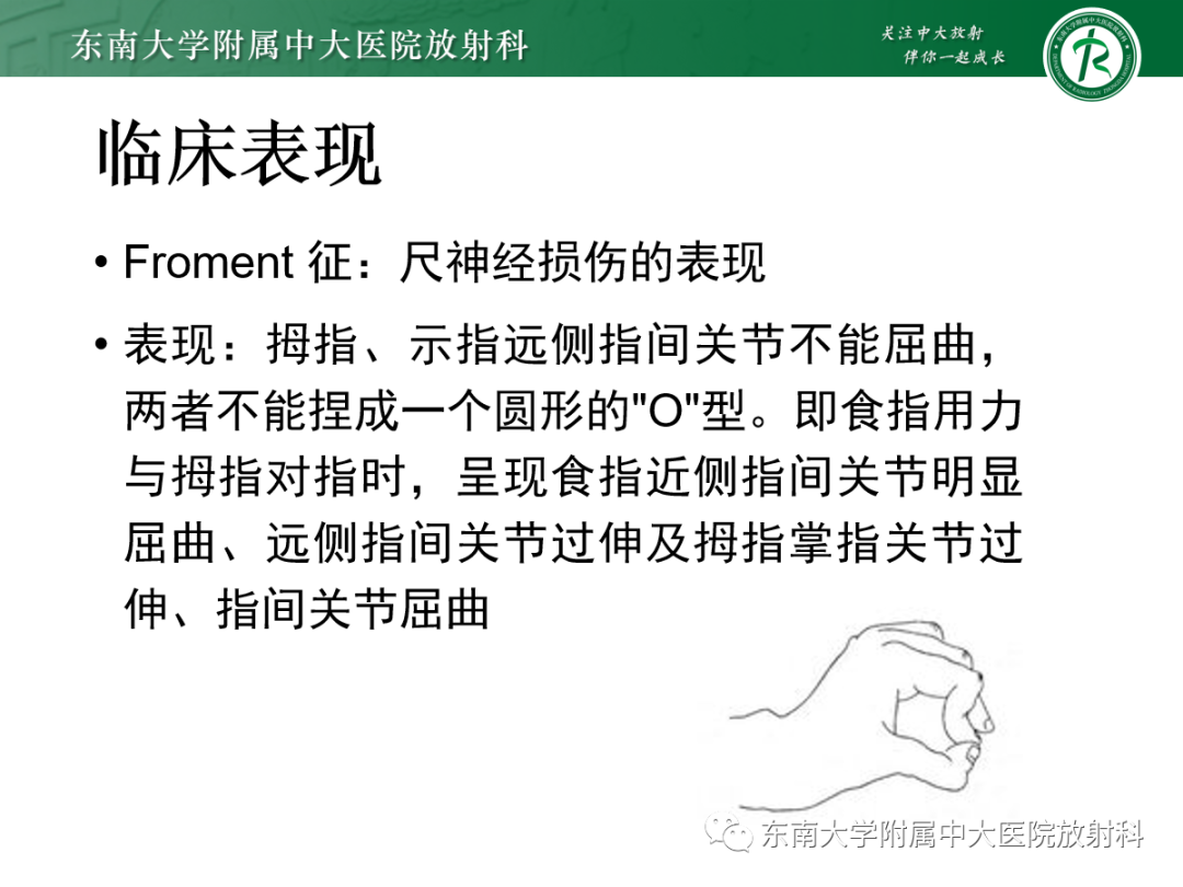 影像PPT - 【PPT】肘管综合征-19