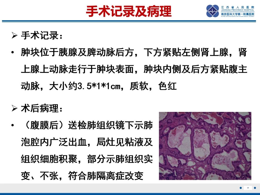 影像PPT - 【PPT】胎儿支气管肺隔离症-21