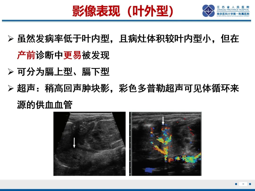 影像PPT - 【PPT】胎儿支气管肺隔离症-33