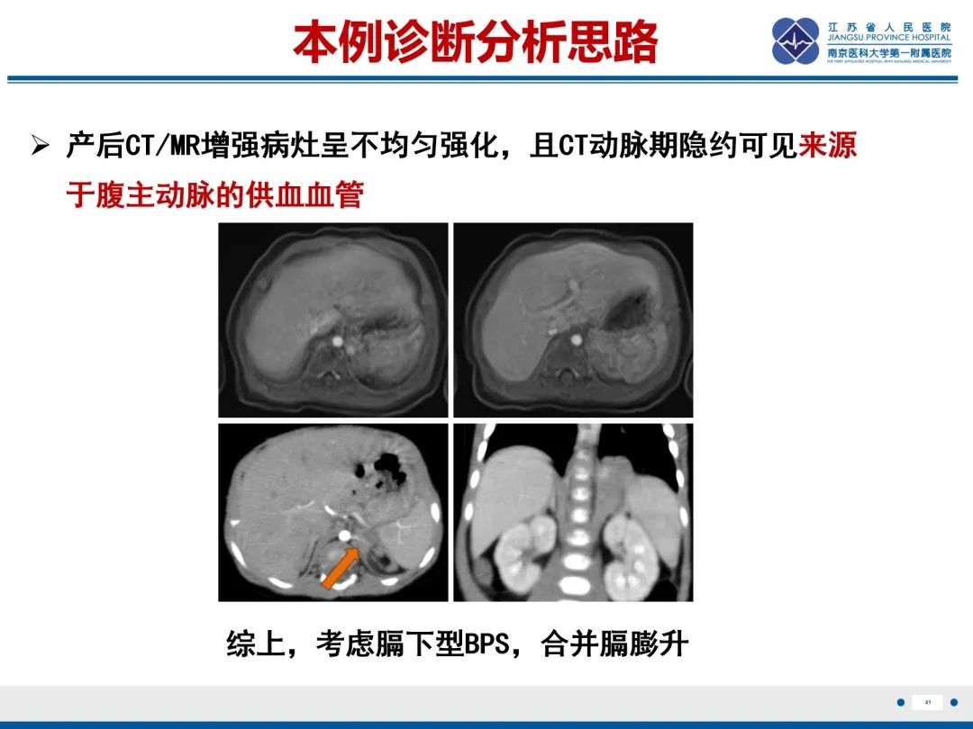 影像PPT - 【PPT】胎儿支气管肺隔离症-42