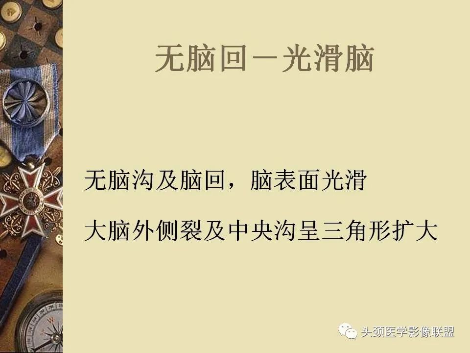 影像PPT - 【PPT】脑部病变的MRI诊断-120