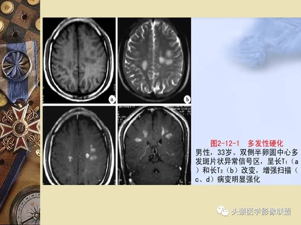影像PPT - 【PPT】脑部病变的MRI诊断-158