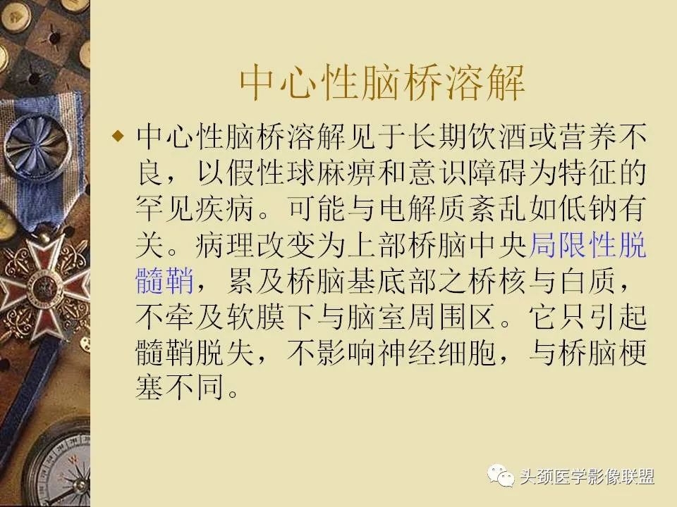 影像PPT - 【PPT】脑部病变的MRI诊断-159