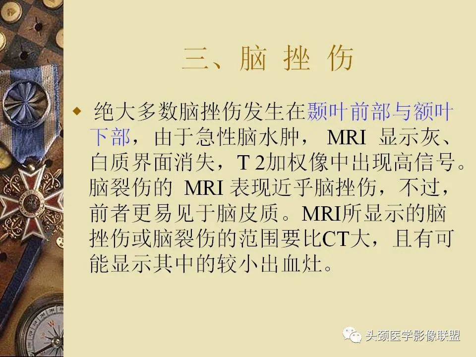 影像PPT - 【PPT】脑部病变的MRI诊断-170