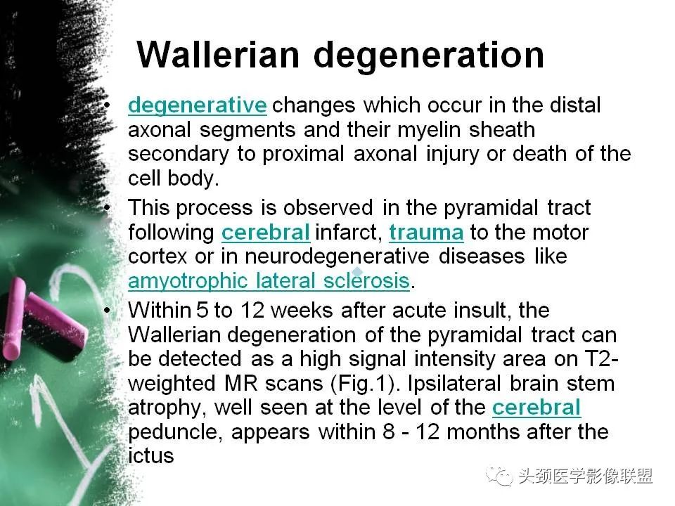 影像PPT - 【PPT】影像异常征象—神经科常见影像征象-62