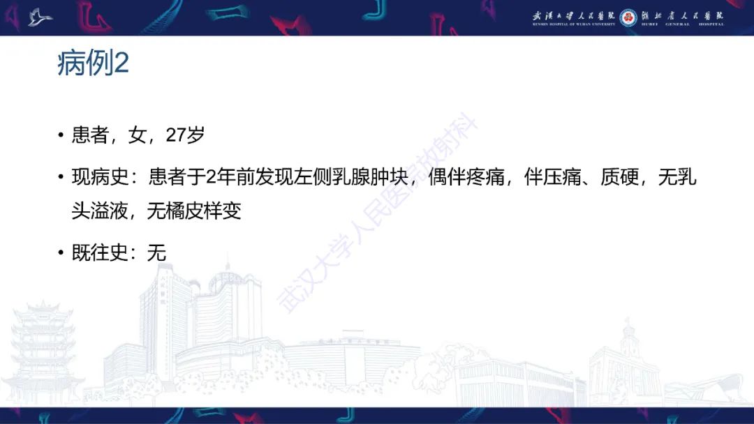 影像PPT - 【PPT】乳腺导管内乳头状瘤影像诊断-4