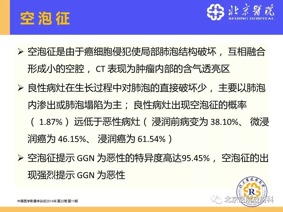 影像PPT - 【PPT】肺磨玻璃结节诊断和应对方法-27