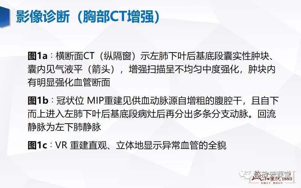 影像PPT - 【PPT】肺隔离症的影像分析-19