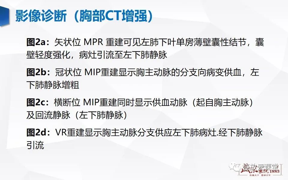 影像PPT - 【PPT】肺隔离症的影像分析-21